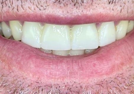 differ_before_image