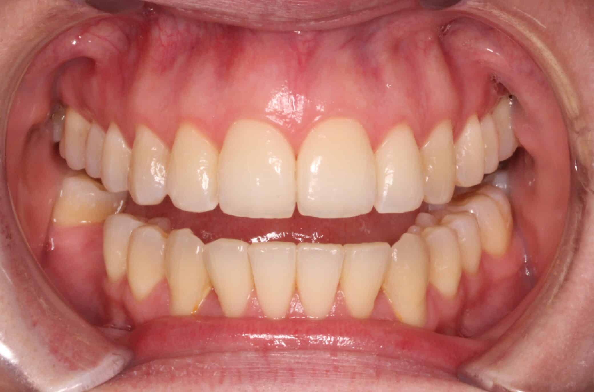 differ_before_image