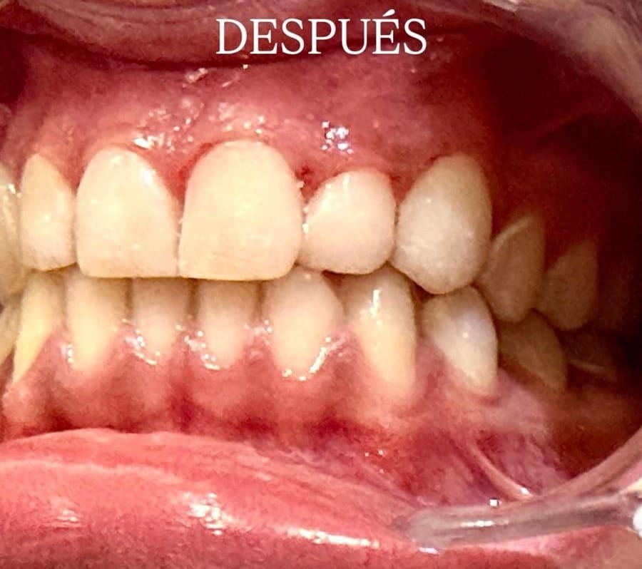 differ_before_image