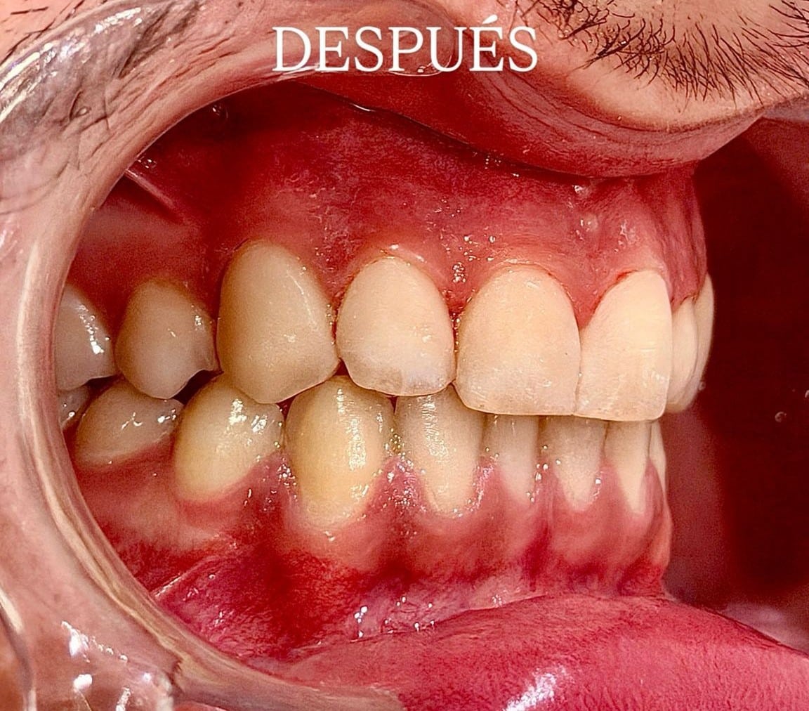differ_before_image