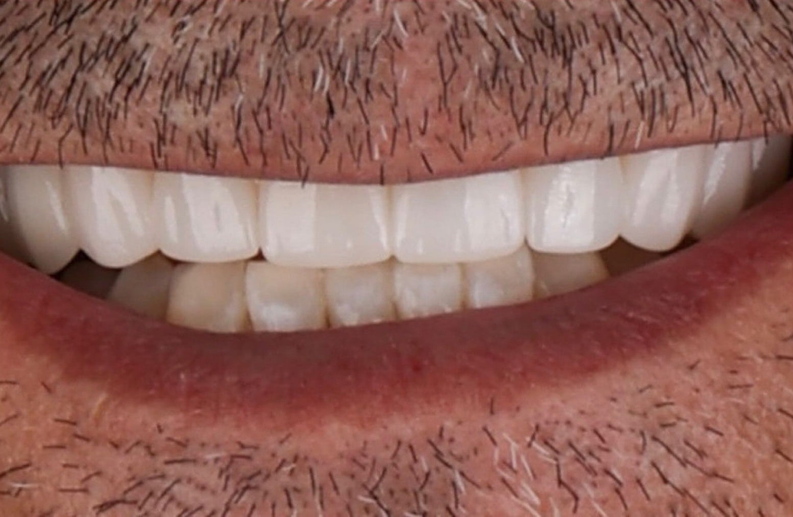 differ_before_image