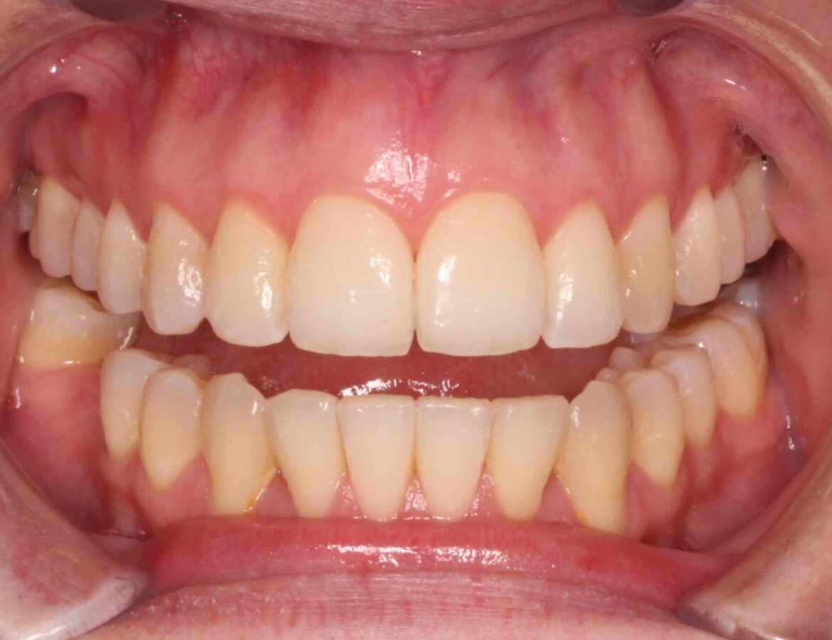differ_before_image