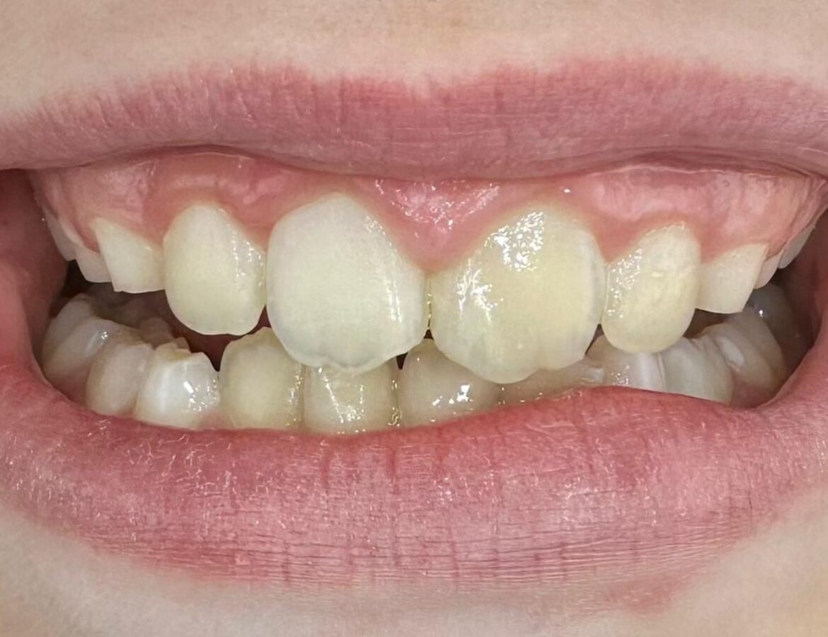 differ_before_image