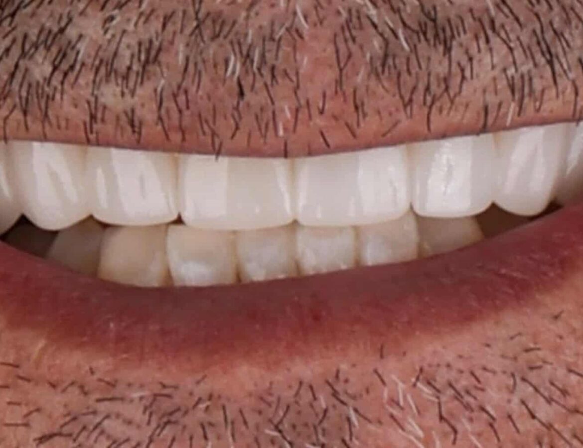 differ_before_image